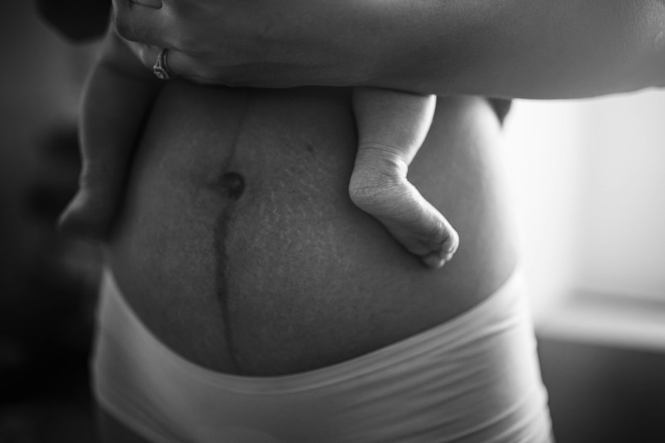 The Importance of Informed Consent